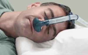 best sleep apnea treatment solutions