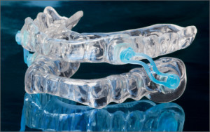choosing the right dental mouth guard for sleep apnea and snoring