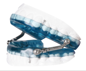 medical review on mouth guard sleep apnea