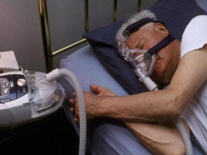 what are the sleep apnea causes